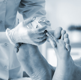 Stem Cell Therapy for Neuropathy